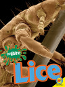 Bugs That Bite: Lice